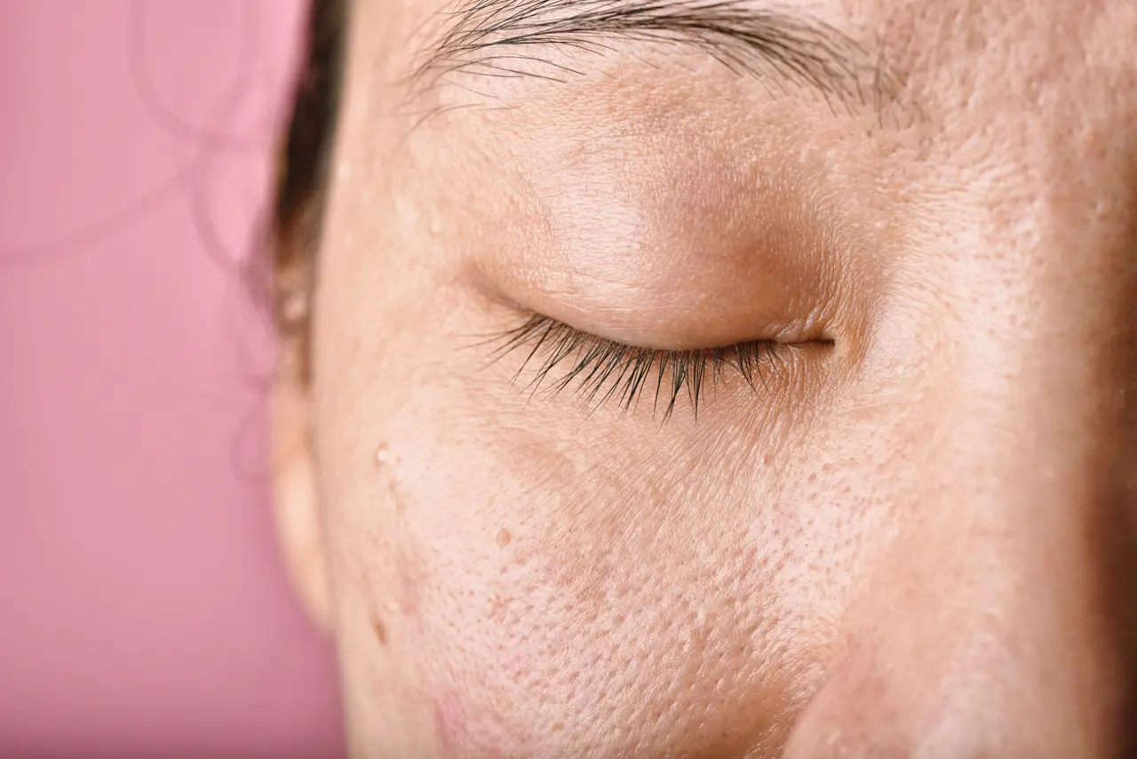 Nourrir et apaiser une peau atopique avec des huiles essentielles