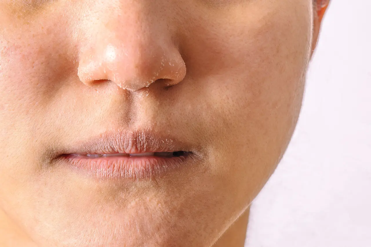 Prendre soin d'une peau déshydratée avec les huiles essentielles